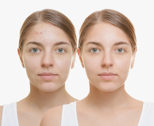 Face Cream