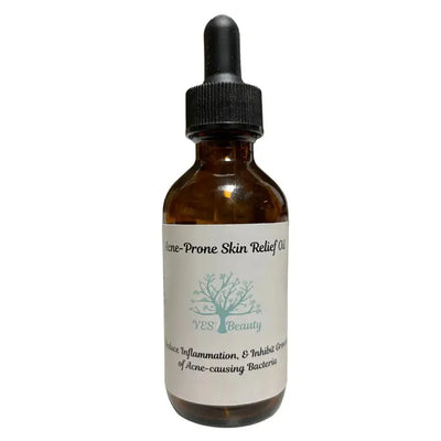 Acne-Prone Skin Relief: Nature’s Gentle Touch with Sunflower, Jojoba, Rosehip, & Grapeseed Oils